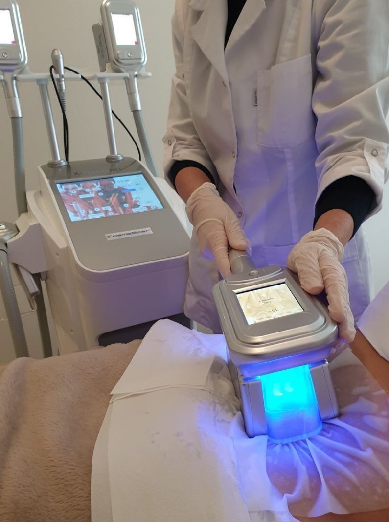 Behandlare utför en Cryo T-shock-behandling på magen